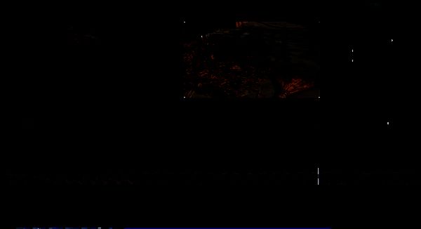 剪映分割视频音乐结尾位置