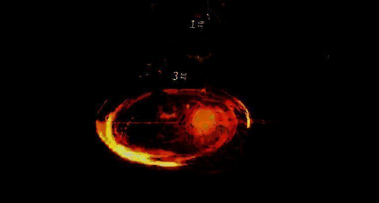 比天寒战斗画面